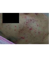 전후사진