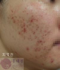 전후사진