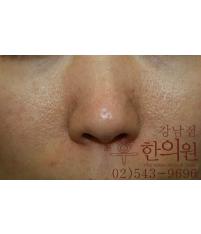 전후사진