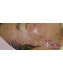 전후사진