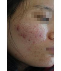 전후사진