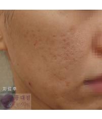 전후사진