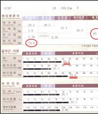 전후사진
