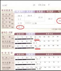 전후사진