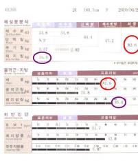 전후사진