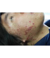 전후사진