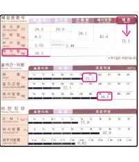 전후사진