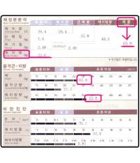 전후사진