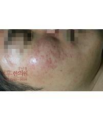 전후사진