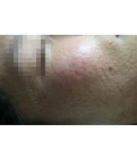 전후사진