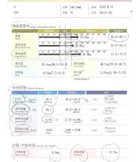 전후사진