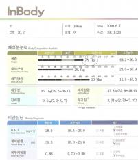 전후사진