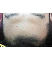 전후사진