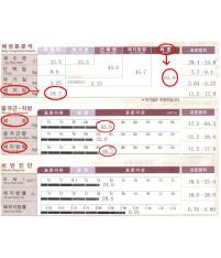 전후사진