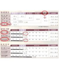 전후사진