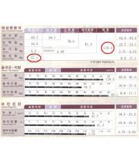 전후사진