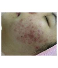 전후사진