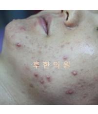 전후사진