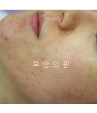 전후사진