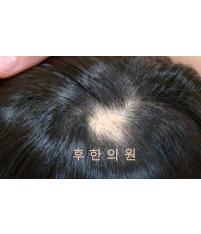 전후사진