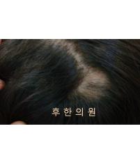 전후사진