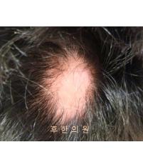 전후사진