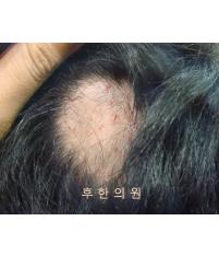 전후사진