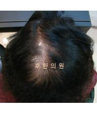 전후사진