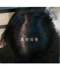 전후사진