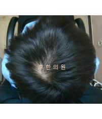 전후사진