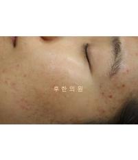 전후사진