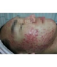 전후사진