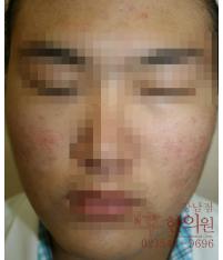 전후사진