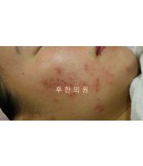 전후사진