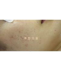 전후사진