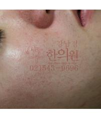 전후사진