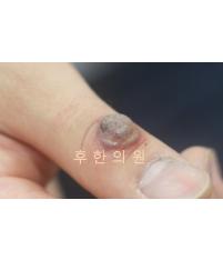 전후사진
