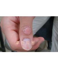 전후사진