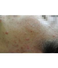 전후사진