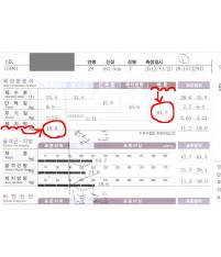 치료 전