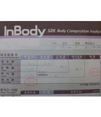 치료 전