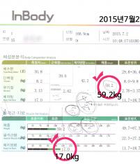 치료 전