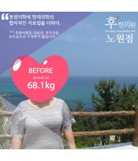 전후사진