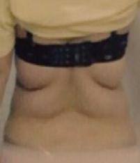 치료 전