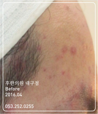 전후사진