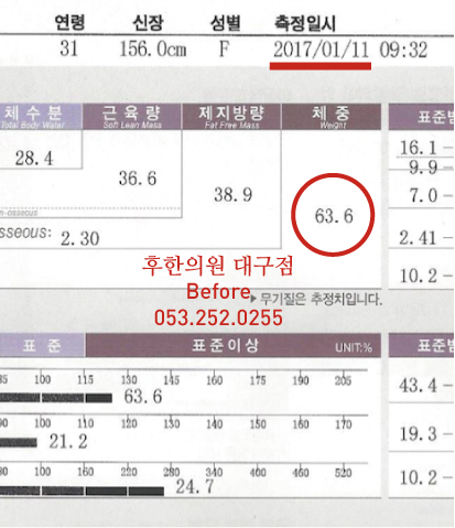 전후사진