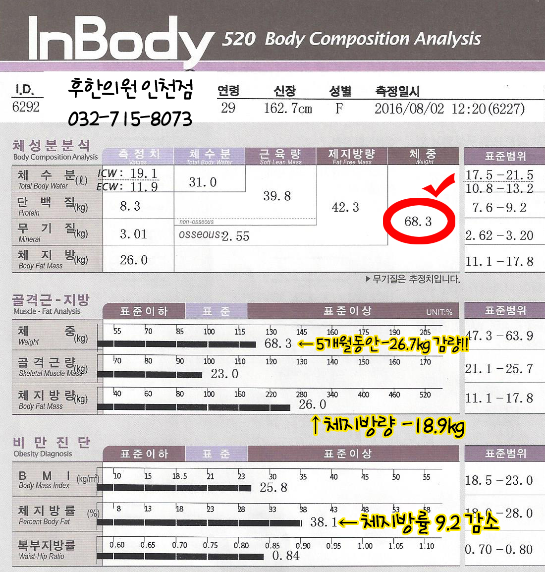 전후사진