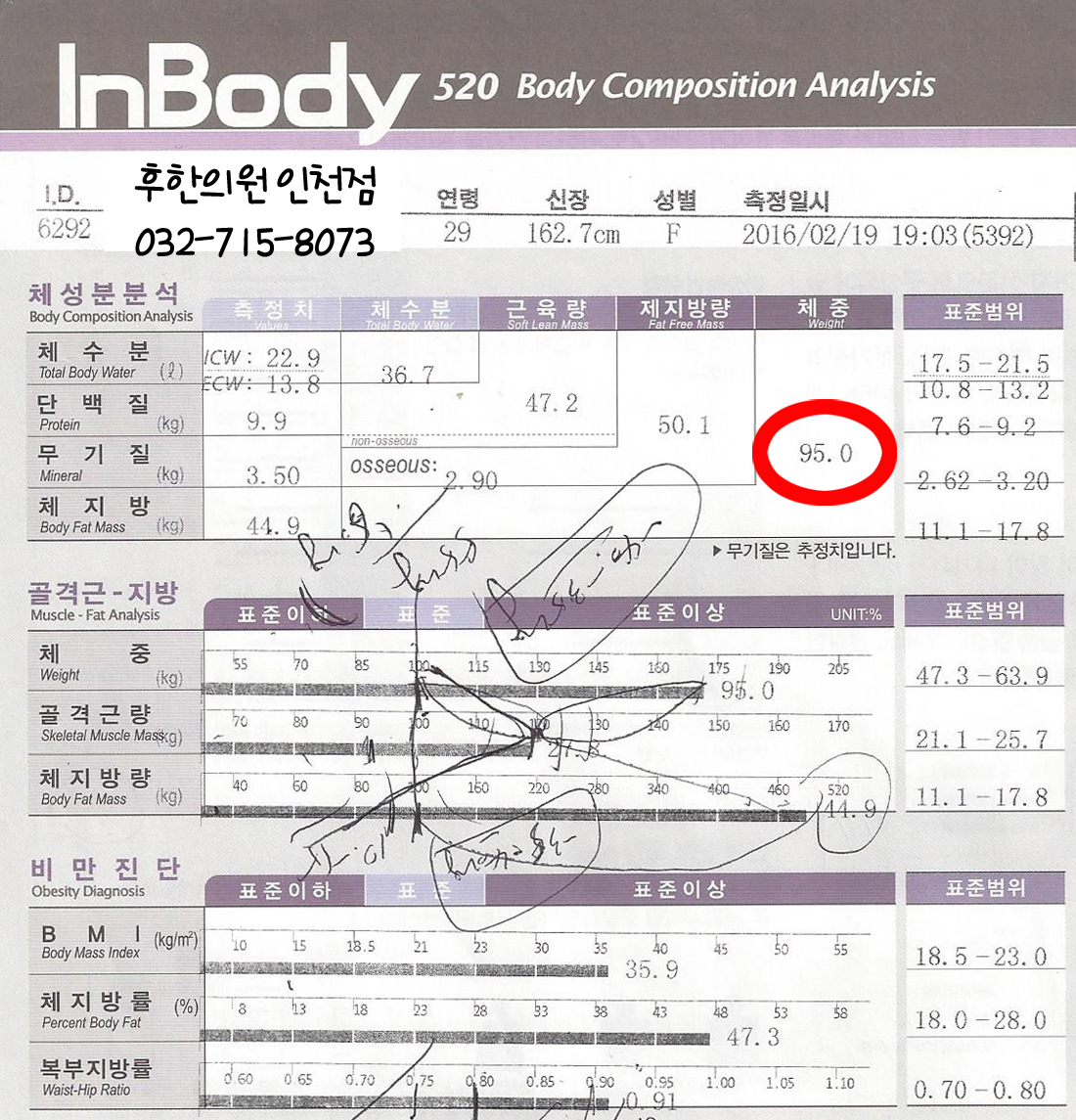 전후사진