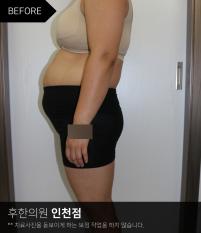 전후사진