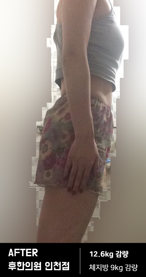 치료 후